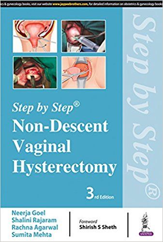 Step By Step Non-Descent Vaginal Hysterectomy By Neerja Goel