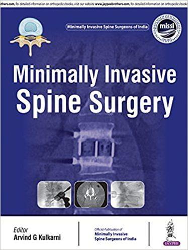Minimally Invasive Spine Surgery 1st Edition 2018 By Arvind G Kulkarni