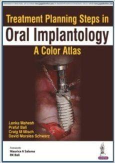 Treatment Planing Steps in ORAL IMPLANTOLOGY A Color Atlas 1st Edition 2018 By Lanka Mahesh