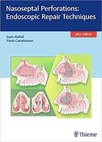 Nasoseptal Perforations Repair Techniques 1st Edition 2017 By Alobid