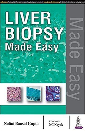 Liver Biopsy Made Easy 1st Edition 2017 By Nalini Bansal Gupta
