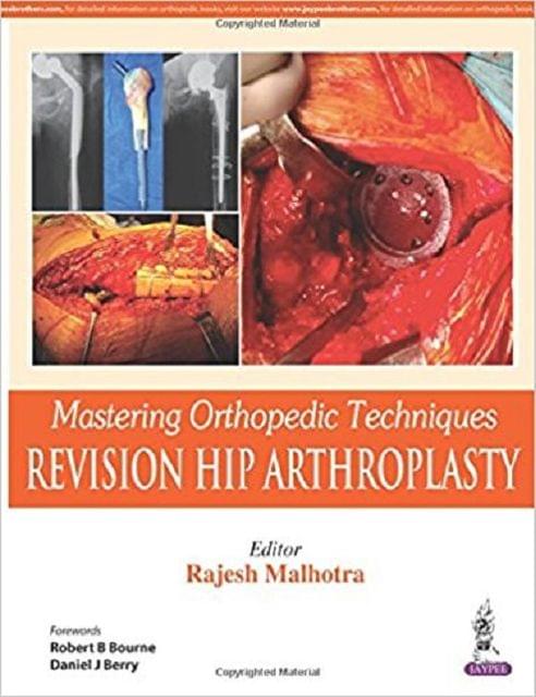 Mastering Orthopedic Techniques Revision Hip Arthroplasty By Rajesh Malhotra