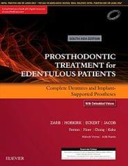 Prosthodontic Treatment for Edentulous Patients: Complete Dentures and Implant-Supported Prostheses 2017 by Zarb