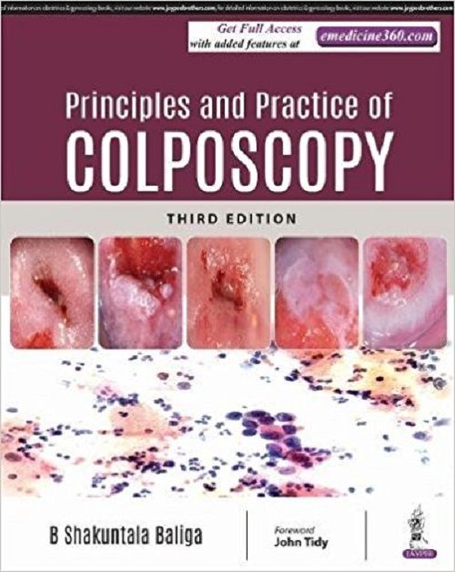 Principle and Practice of Colposcopy 3rd Edition 2018 By B Shakuntala Baliga