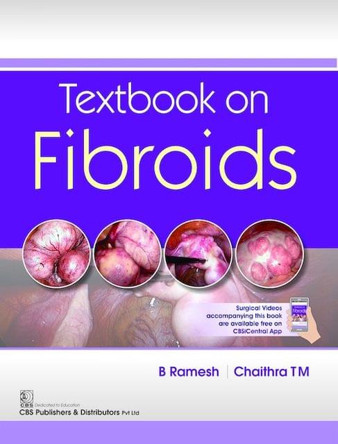 Textbook on Fibroids by B Ramesh