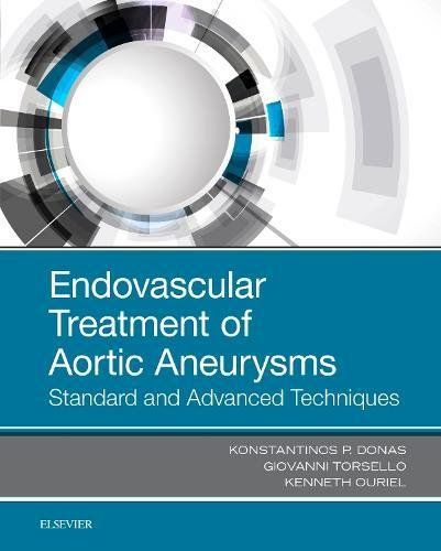 Endovascular Treatment of Aortic Aneurysms 1st edition 2018 by Konstantinos P. Donas