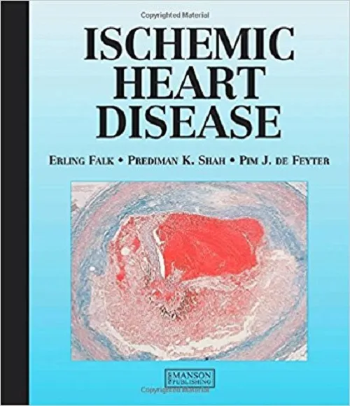 Ischemic Heart Disease By Erling Falk