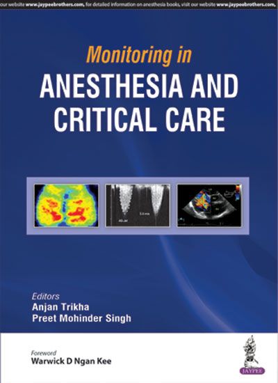 Monitoring in Anesthesia and Critical Care, 1st edition 2018 by Anjan Trikha