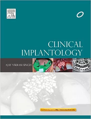 Clinical Implantology 1st Edition 2013 By Ajay Vikram Singh
