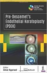 Pre Descemet's Endothelial Keratoplasty Pdek 1st Edition 2018 by Amar Agarwal