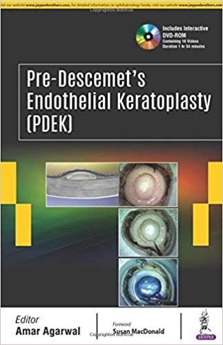 Pre Descemet's Endothelial Keratoplasty Pdek 1st Edition 2018 by Amar Agarwal