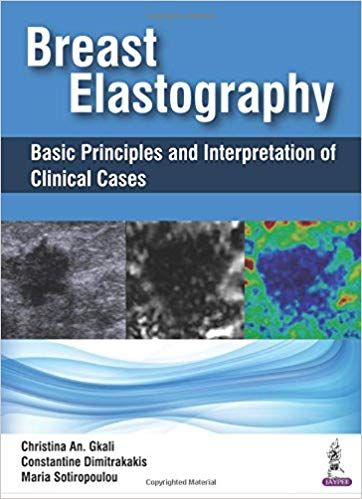Breast Elastography Basic Principles and Interpretation of Clinical Cases 1st Editon 2018 By Christina An Gkali