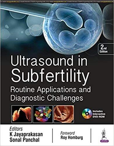 Ultrasound in Subfertility Routine Applications and Diagnostic 2nd Edition 2018 By K Jayaprakasan