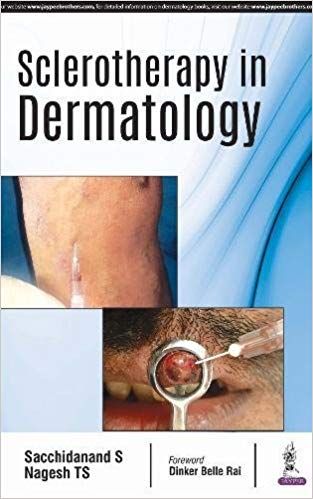 Sclerotherapy in Dermatology 1st Edition 2018 By Sacchidanand S
