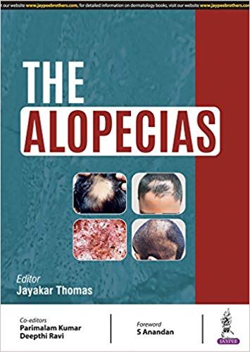 The Alopecias 1st Edition 2018 By Jayakar Thomas
