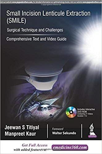 Small Incision Lenticule Extraction SMILE Surgical Technique and Challenges 1st Edition 2018 By Jeewan S Titiyal