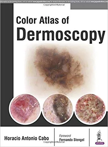 Color Atlas of Dermoscopy 1st Edition 2017 By Horacio Antonio Cabo
