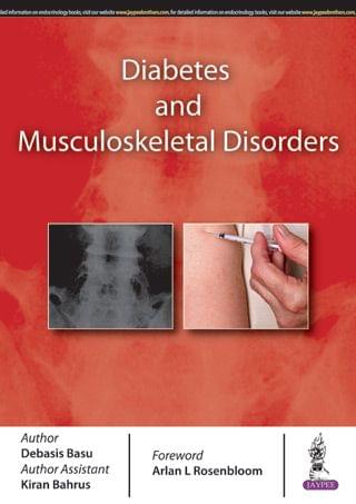 Diabetes And Musculoskeletal Disorders 1st Edition 2017 by Debasis Basu