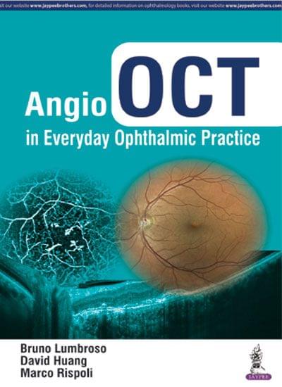 Angio Oct In Everyday Ophthalmic Practice 1st Edition 2017 by Bruno Lumbroso