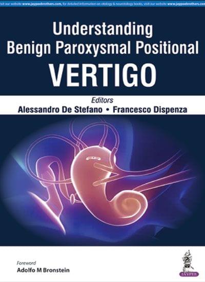 Understanding Benign Paroxysmal Positional Vertigo 1st Edition 2017 by Alessandro De Stefano