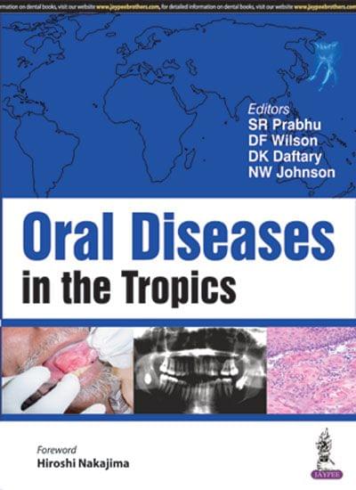 Oral Diseases In The Tropics 1st Edition 2017 by Sr Prabhu
