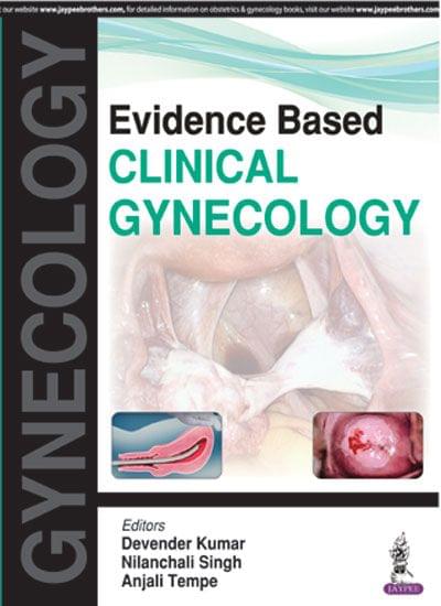 Evidence Based Clinical Gynecology 1st Edition 2017 by Devender Kumar
