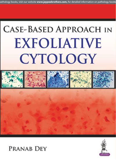 Case Based Approach In Exfoliative Cytology 1st Edition 2017 by Pranab Dey