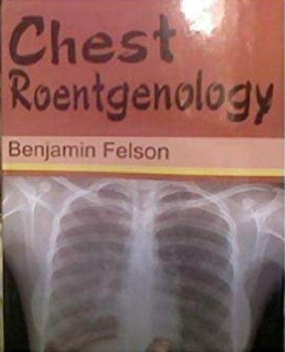 Chest Roentgenology By Benjamin Felson