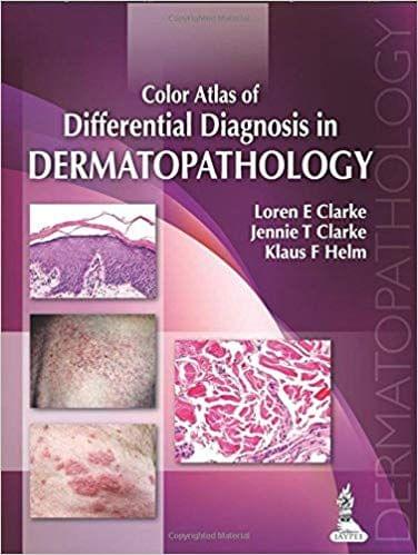 Color Atlas of Differential Diagnosis in Dermatopathology 1st Edition 2014 By Loren E Clarke