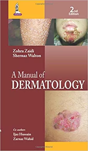 A Manual Of Dermatology 2nd Edition 2015 By Zaidi Zohra