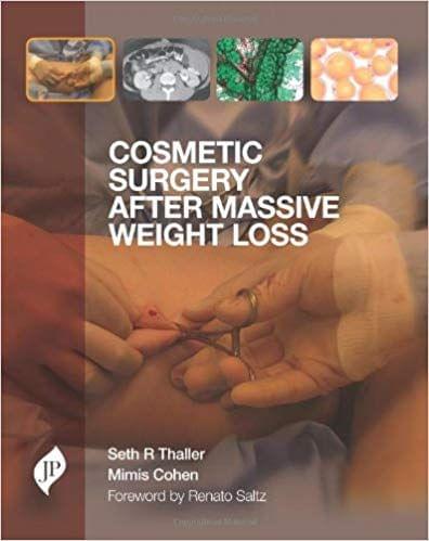 Cosmetic Surgery After Massive Weight Loss By Cohen Seth R Thaller