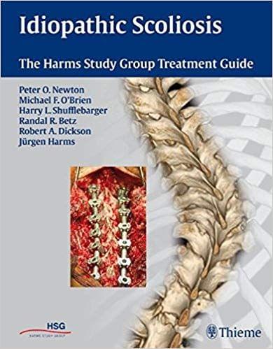 Idiopathic Scoliosis: The Harms Study Group Treatment Guide 1st Edition 2010 By Peter O. Newton