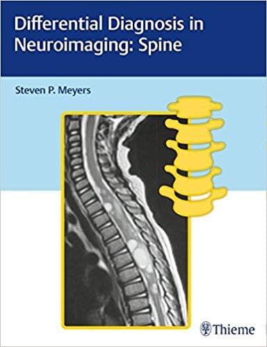 Differential Diagnosis in Neuroimaging: Spine 2016 By Steven Meyers