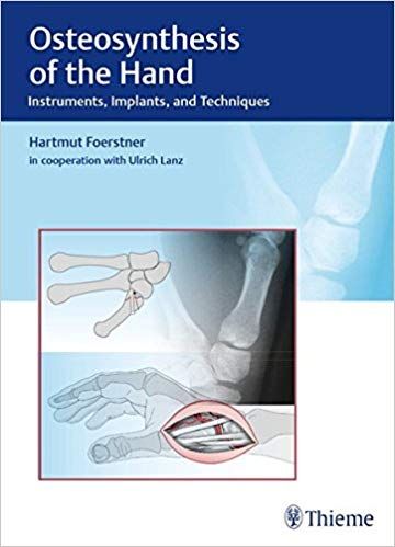 Osteosynthesis of the Hand 1st Edition 2016 By F?_rstner