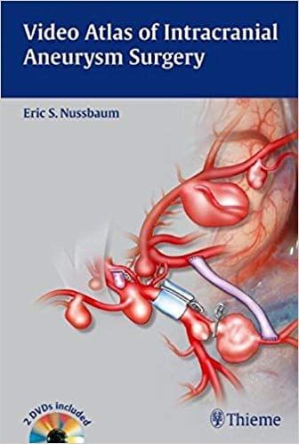 Video Atlas of Intracranial Aneurysm Surgery 2012 By Eric Nussbaum