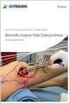 Minimally Invasive Plate Osteosynthesis (MIPO) 2nd Edition 2012 By Reto Babst