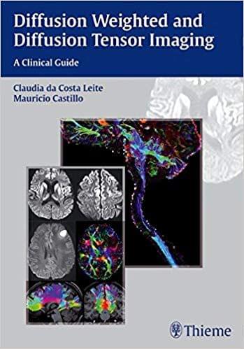 Diffusion Weighted and Diffusion Tensor Imaging 2015 By Claudia Leite
