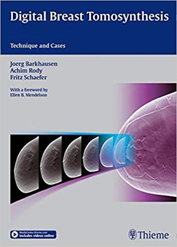 Digital Breast Tomosynthesis: Technique and Cases 2015 By Barkhausen