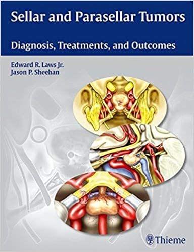 Sellar and Parasellar Tumors: Diagnosis, Treatments and Outcomes 2014 By Edward R. Laws