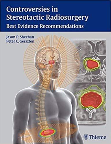 Controversies in Stereotactic Radiosurgery 2014 By Jason P. Sheehan