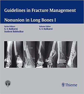 GUIDELINES IN FRACTURE MANAGEMENT - NONUNION IN LONG BONES I 2014 By Kulkarni