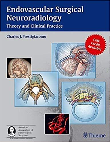 Endovascular Surgical Neuroradiology 1st Edition 2015 By Charles J. Prestigiacomo