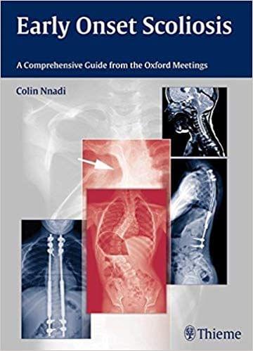 Early Onset Scoliosis: A Comprehensive Guide from the Oxford Meetings 1st Edition 2015 By Colin Nnadi