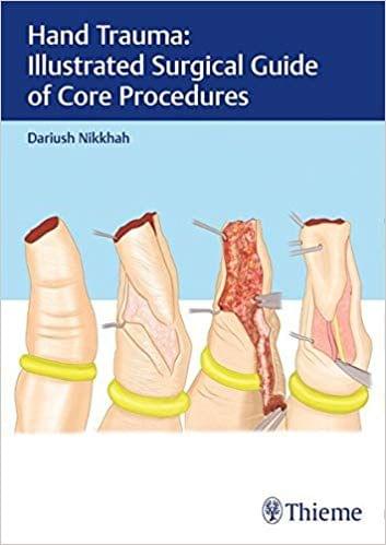 Hand Trauma: Illustrated Surgical Guide of Core Procedures 1st Edition 2017 By  Nikkhah