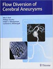 Flow Diversion of Cerebral Aneurysms 1st Edition 2017 By Park