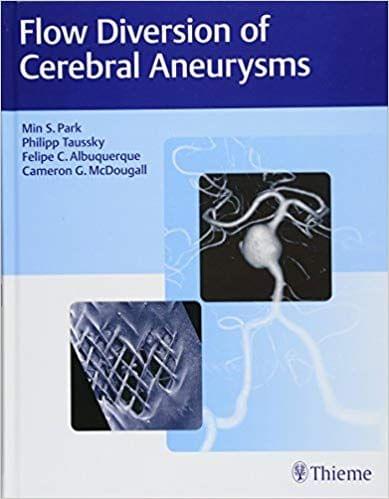 Flow Diversion of Cerebral Aneurysms 1st Edition 2017 By Park