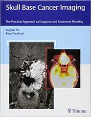 Skull Base Cancer Imaging 1st Edition 2017 By Yu
