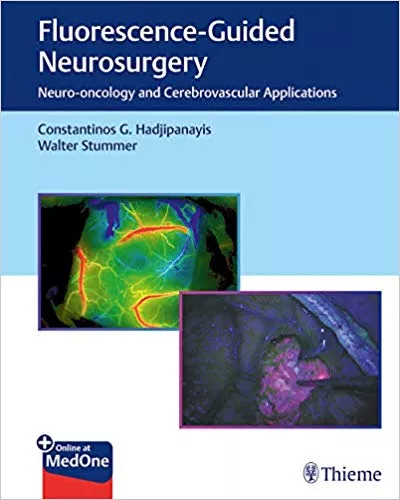 Fluorescence-Guided Neurosurgery: Neuro-oncology and Cerebrovascular Applications 2019 By Constantinos G. Hadjipanayis