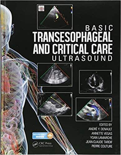 Basic Transesophageal and Critical Care Ultrasound 2017 By Andr? Denault