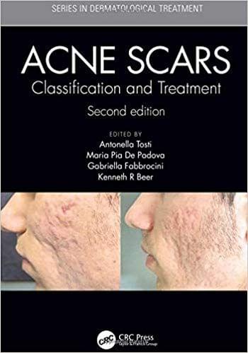 Acne Scars: Classification and Treatment, Second Edition 2018 By Antonella Tosti